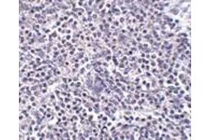 Immunohistochemistry of ARL15 in human spleen tissue with ARL15 antibody at 5 μg/ml. (ARL15 抗体  (Center))