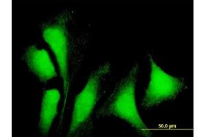 Immunofluorescence of purified MaxPab antibody to G3BP1 on HeLa cell. (G3BP1 抗体  (AA 1-466))