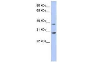 Image no. 1 for anti-Homeobox C5 (HOXC5) (C-Term) antibody (ABIN6742851) (Homeobox C5 抗体  (C-Term))