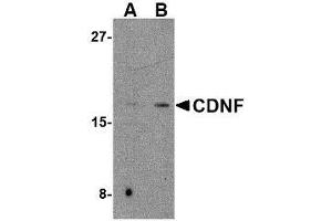 Western blot analysis of CDNF in mouse brain tissue lysate with AP30221PU-N CDNF antibody at (A) 2 and (B) 4 μg/ml. (CDNF 抗体  (C-Term))