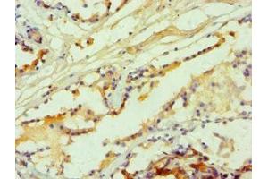Immunohistochemistry of paraffin-embedded human prostate tissue using ABIN7142626 at dilution of 1:100 (Serotonin Receptor 2B 抗体  (AA 382-481))