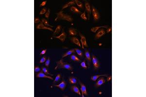 Immunofluorescence analysis of U-2 OS cells using MLPH antibody (ABIN6128273, ABIN6143892, ABIN6143893 and ABIN6222354) at dilution of 1:100. (Melanophilin 抗体  (AA 301-600))