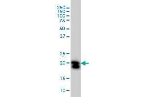 Western Blotting (WB) image for anti-Ras Homolog Gene Family, Member A (RHOA) (AA 1-193) antibody (ABIN559932)