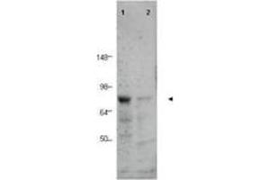 Image no. 1 for anti-CCCTC-Binding Factor (Zinc Finger Protein)-Like (CTCFL) (AA 9-26) antibody (ABIN199968) (CTCFL 抗体  (AA 9-26))