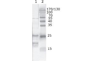 Western Blot testing of HIV-1 recombinant Tat protein. (HIV-1 Tat 抗体  (AA 2-9))