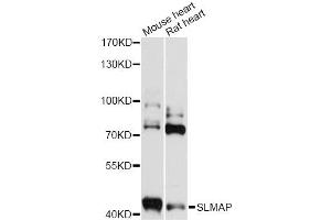 Western blot analysis of extracts of various cell lines, using SLMAP antibody (ABIN6293579) at 1:3000 dilution. (SLMAP 抗体)