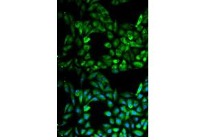 Immunofluorescence (IF) image for anti-Inhibitor of kappa Light Polypeptide Gene Enhancer in B-Cells, Kinase gamma (IKBKG) (AA 1-419) antibody (ABIN3021151)