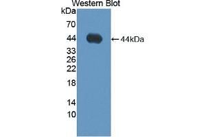 Detection of Recombinant ADAMTS19, Human using Polyclonal Antibody to A Disintegrin And Metalloproteinase With Thrombospondin 19 (ADAMTS19) (ADAMTS19 抗体  (AA 325-686))