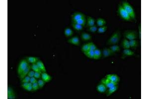 Immunofluorescent analysis of PC-3 cells using ABIN7153293 at dilution of 1:100 and Alexa Fluor 488-congugated AffiniPure Goat Anti-Rabbit IgG(H+L) (GRK4 抗体  (AA 1-245))