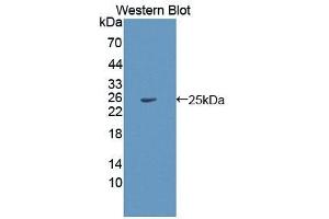 Detection of Recombinant HPS4, Human using Polyclonal Antibody to Hermansky Pudlak Syndrome Protein 4 (HPS4) (HPS4 抗体  (AA 6-192))