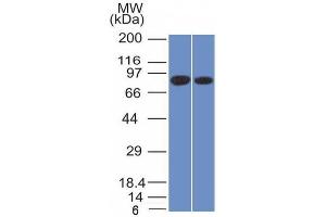 Western Blot of Analysis of PANC1 and MCF-7 cell lysate using Calnexin Mouse Monoclonal Antibody (CANX/1543). (Calnexin 抗体  (N-Term))