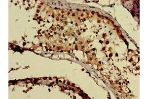 Immunohistochemistry of paraffin-embedded human testis tissue using ABIN7154703 at dilution of 1:100 (GNAQ 抗体  (AA 1-359))