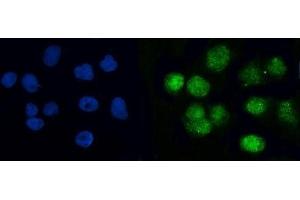 IF analysis of BRCC36/BRCC3 using anti-BRCC36/BRCC3 antibody (ABIN7599595). (BRCC3 抗体  (AA 10-276))