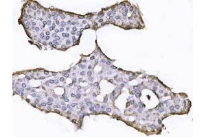 IHC analysis of SUN2 using anti-SUN2 antibody (ABIN7601278).
