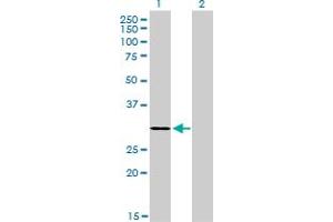 Western Blot analysis of LDB3 expression in transfected 293T cell line by LDB3 monoclonal antibody (M06A), clone 3C8. (LIM Domain Binding 3 Protein 抗体  (AA 1-283))