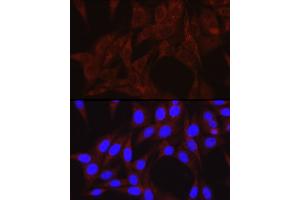 Immunofluorescence analysis of NIH/3T3 cells using PIK3C3/VPS34 Rabbit pAb (ABIN6134410, ABIN6145632, ABIN6145634 and ABIN6216127) at dilution of 1:50 (40x lens). (PIK3C3 抗体  (AA 150-250))