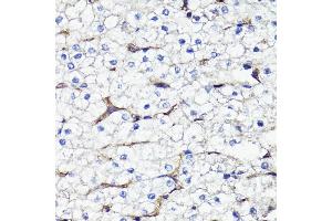Immunohistochemistry of paraffin-embedded human liver using CD44 antibody (ABIN7266201) at dilution of 1:100 (40x lens). (CD44 抗体  (AA 346-385))