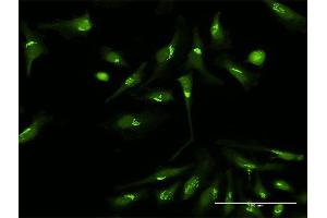 Immunofluorescence of purified MaxPab antibody to PDXDC1 on HeLa cell. (PDXDC1 抗体  (AA 1-788))