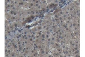 Immunohistochemistry (IHC) image for anti-Superoxide Dismutase 1, Soluble (SOD1) (AA 2-153) antibody (ABIN7443155)