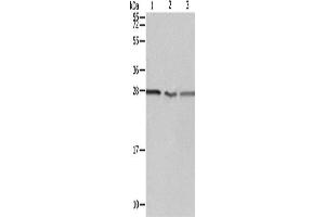 Western Blotting (WB) image for anti-Proteasome (Prosome, Macropain) 26S Subunit, Non-ATPase, 9 (PSMD9) antibody (ABIN2428649) (PSMD9 抗体)