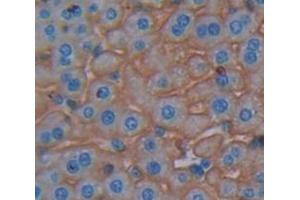 IHC-P analysis of Mouse Tissue, with DAB staining. (Dystrophin 抗体  (AA 3059-3314))