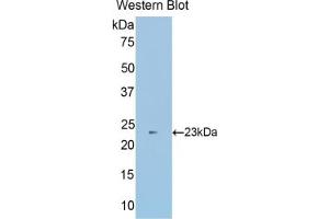 WB of Protein Standard: different control antibodies against Highly purified E. (SUOX ELISA 试剂盒)