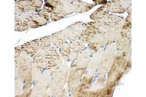 Immunohistochemistry (IHC) image for anti-ATPase, Ca++ Transporting, Cardiac Muscle, Fast Twitch 1 (ATP2A1) (AA 665-680), (Middle Region) antibody (ABIN3044279)