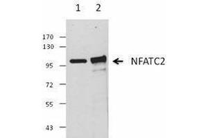 Western Blotting (WB) image for anti-Nuclear Factor of Activated T-Cells, Cytoplasmic, Calcineurin-Dependent 2 (NFAT1) antibody (ABIN2665286) (NFAT1 抗体)