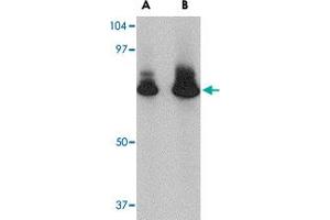 Western blot analysis of ATG16L1 in HeLa cell lysate with ATG16L1 polyclonal antibody  at (A) 1 and (B) 2 ug/mL . (ATG16L1 抗体  (N-Term))