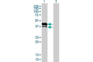 Western Blot analysis of GPD2 expression in transfected 293T cell line by GPD2 monoclonal antibody (M02), clone 2C11-1F4. (GPD2 抗体  (AA 1-378))
