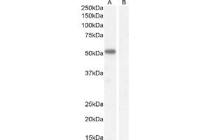 (ABIN570827) (1 μg/mL) staining of Mouse Heart lysate (35 μg protein in RIPA buffer). (IKZF4 抗体  (Internal Region))
