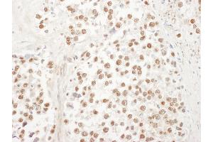 Immunohistochemistry (IHC) image for anti-Ubiquitin-Like 7 (Bone Marrow Stromal Cell-Derived) (UBL7) (AA 330-380) antibody (ABIN7454886) (UBL7 抗体  (AA 330-380))