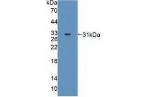 Detection of Recombinant MAPK12, Human using Polyclonal Antibody to Mitogen Activated Protein Kinase 12 (MAPK12)