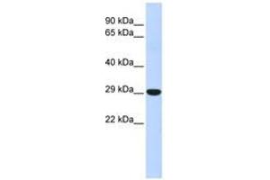 Image no. 1 for anti-Homeobox B8 (HOXB8) (N-Term) antibody (ABIN6740614) (HOXB8 抗体  (N-Term))