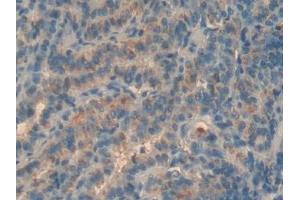 Detection of MBP in Human Thyroid Tissue using Polyclonal Antibody to Major Basic Protein (MBP) (Major Basic Protein 抗体  (AA 105-222))