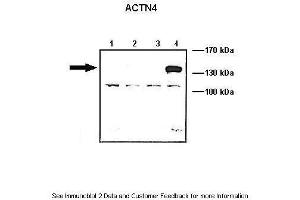 Lanes:   Lane1: 10 ug ACTN1-GFP transfected COS-7 lysate Lane2: 10 ug ACTN2-GFP transfected COS-7 lysate Lane3: 10 ug ACTN3-GFP transfected COS-7 lysate Lane4: 10 ug ACTN4-GFP transfected COS-7 lysate  Primary Antibody Dilution:   1: 1000  Secondary Antibody:   Anti-rabbit HRP  Secondary Antibody Dilution:   1:5000  Gene Name:   ACTN4  Submitted by:   Johannes W. (alpha Actinin 4 抗体  (N-Term))