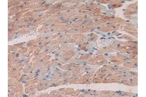 Detection of SDF1 in Mouse Heart Tissue using Polyclonal Antibody to Stromal Cell Derived Factor 1 (SDF1) (CXCL12 抗体  (AA 22-89))