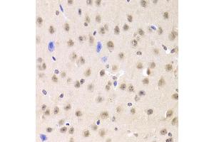 Immunohistochemistry of paraffin-embedded mouse brain using PRPF3 Antibody (ABIN5973192) at dilution of 1/100 (40x lens). (PRPF3 抗体)