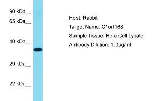 Host: Rabbit Target Name: C1ORF168 Sample Tissue: Human Hela Whole cell Antibody Dilution: 1ug/ml (C1ORF168 抗体  (N-Term))