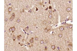 Immunohistochemistry (Paraffin-embedded Sections) (IHC (p)) image for anti-PTK2B Protein tyrosine Kinase 2 beta (PTK2B) (pTyr402) antibody (ABIN745763)