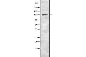 Western blot analysis Synphilin-1 using LOVO whole cell lysates (SNCAIP 抗体  (Internal Region))