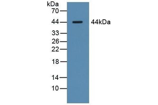 Asialoglycoprotein Receptor 1 抗体  (AA 77-289)