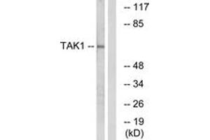Western blot analysis of extracts from HepG2 cells, using TAK1 (Ab-184) Antibody. (TR4 抗体  (AA 161-210))