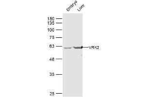 Lane 1: mouse embryo lysates Lane 2: mouse liver lysates probed with VRK2 Polyclonal Antibody, Unconjugated  at 1:300 dilution and 4˚C overnight incubation. (VRK2 抗体  (AA 151-250))