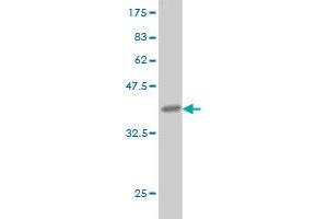 Western Blot detection against Immunogen (36. (Laminin alpha 5 抗体  (AA 1-100))