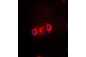 Immunofluorescence (IF) image for anti-Cytochrome P450, Family 2, Subfamily J, Polypeptide 2 (CYP2J2) (Center) antibody (ABIN7295456)