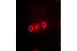 Immunofluorescent analysis of Cytochrome P450 2J2 staining in A549 cells. (CYP2J2 抗体  (Center))