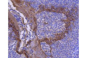Paraformaldehyde-fixed, paraffin embedded human tonsil tissue, Antigen retrieval by boiling in sodium citrate buffer (pH6) for 15min, Block endogenous peroxidase by 3% hydrogen peroxide for 30 minutes, Blocking buffer (normal serum) at 37°C for 20min, Antibody incubation with Cytokeratin 2e (2F7) Monoclonal Antibody  at 1:50 overnight at 4°C, followed by a conjugated secondary and DAB staining. (Keratin 2 抗体)