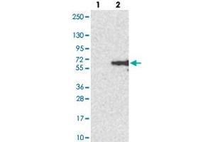 Western blot analysis of Lane 1: Negative control (vector only transfected HEK293T lysate). (CLN5 抗体)