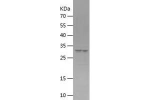 Western Blotting (WB) image for P21-Activated Kinase 4 (PAK4) (AA 1-259) protein (His tag) (ABIN7124293) (PAK4 Protein (AA 1-259) (His tag))